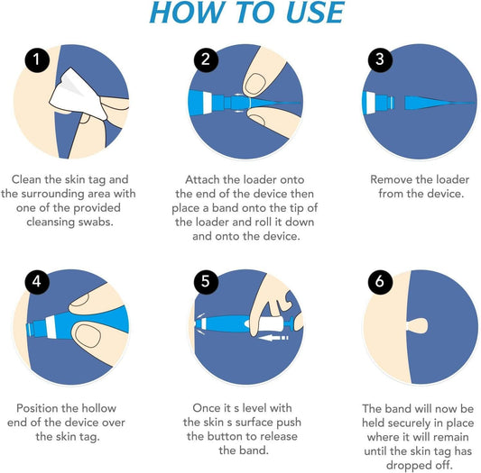 2 in 1 Skin Tag Remover Kit